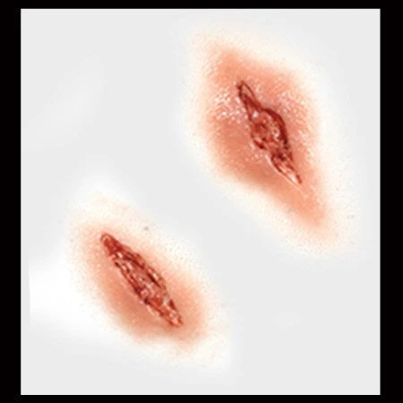 Tinsley Transfers Prosthetics Shanked 5 Tinsley Transfers Prosthetics Shanked