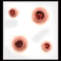 Tinsley Transfers Prosthetics Capped