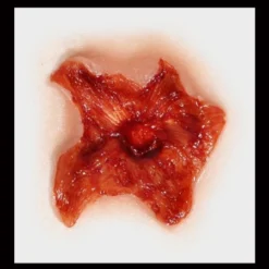 Tinsley Transfers Exit Wound